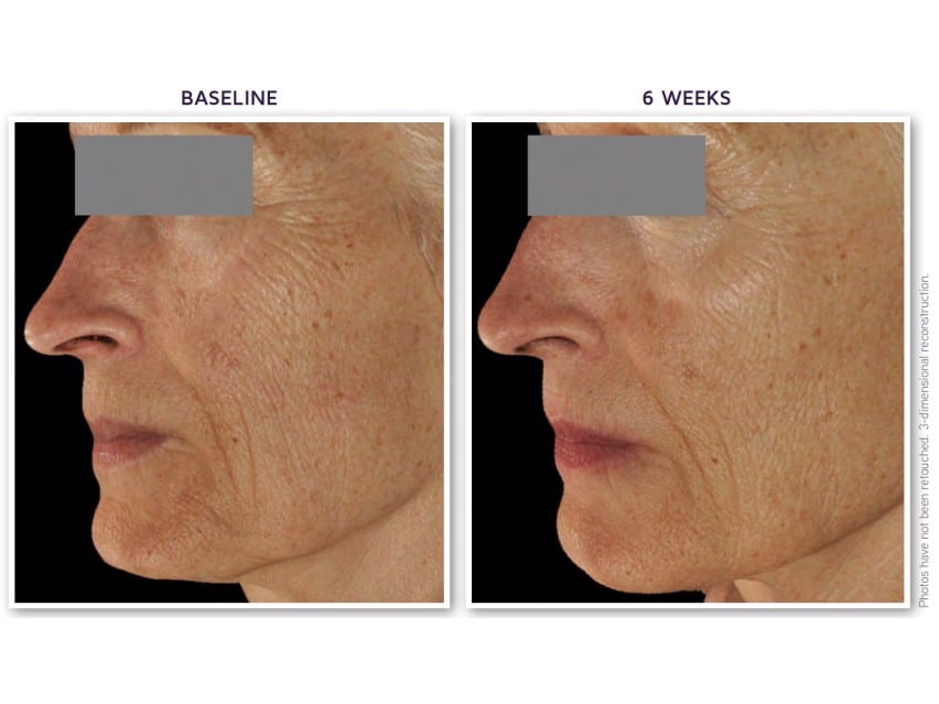 DefenAge Clinical Power Trio +